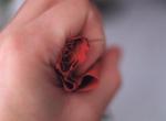 rose 10