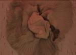 Undress
